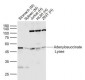 Adenylosuccinate Lyase Polyclonal Antibody